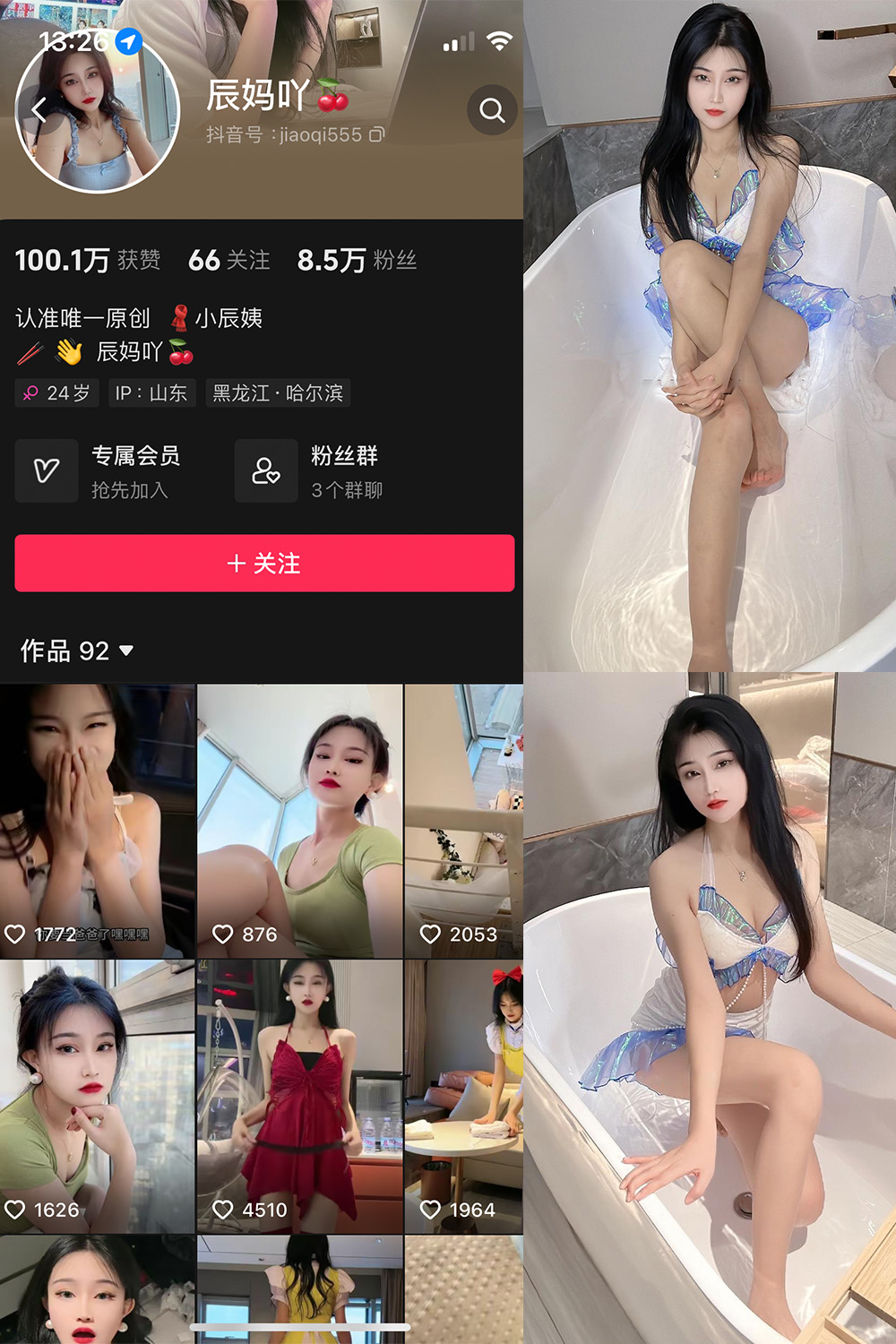 抖音 辰妈吖 微密圈  NO.001期 【32P4V】-写真