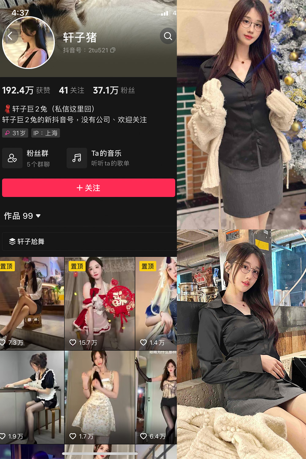 抖音 轩子巨二兔 微密圈  NO.016期 【10P】最新至：2023.11.30-写真