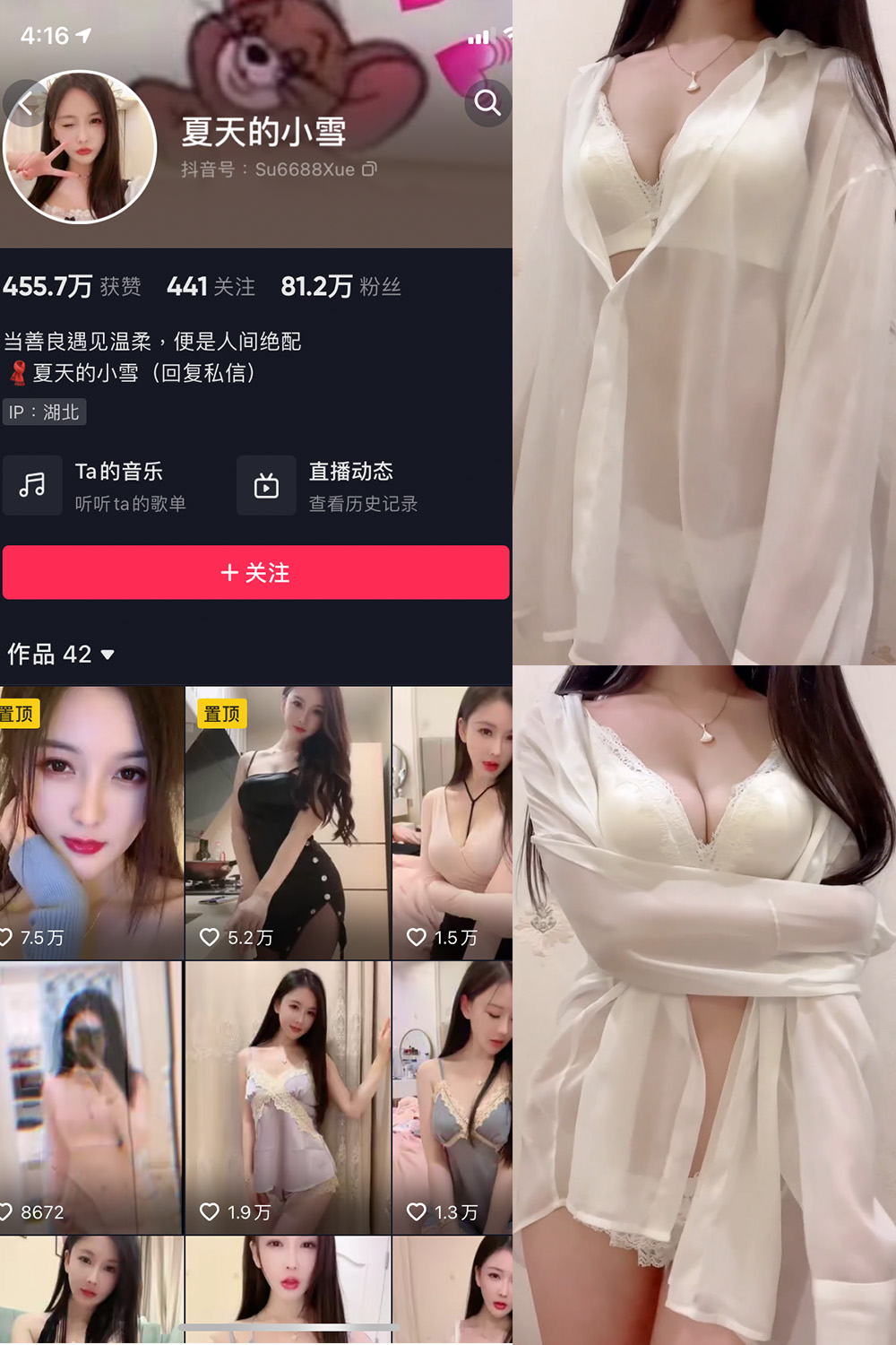 图片[1]-抖音 BT富儿 微密圈 019期 【3P2V】最新至：2025.4.21-微私密圈-全网最全抖音网红铁粉写真空间
