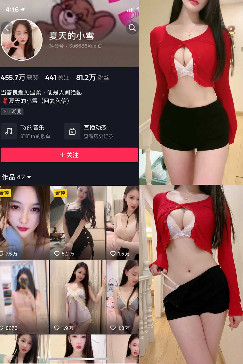 图片[1]-抖音 BT富儿 微密圈 019期 【3P2V】最新至：2025.4.21-微私密圈-全网最全抖音网红铁粉写真空间